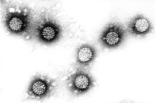 인유두종 바이러스